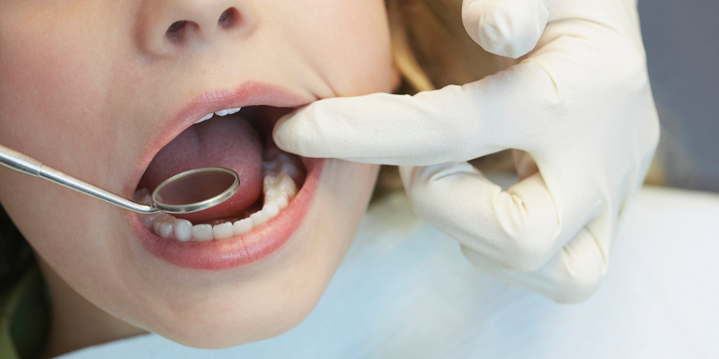 Tooth Extraction in Walkertown, North Carolina