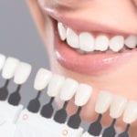 Teeth Whitening in Winston-Salem, North Carolina