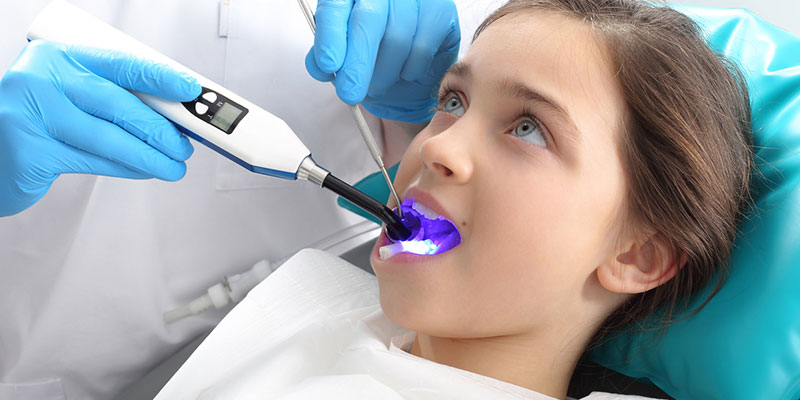 Dental sealants are quick to apply and painless